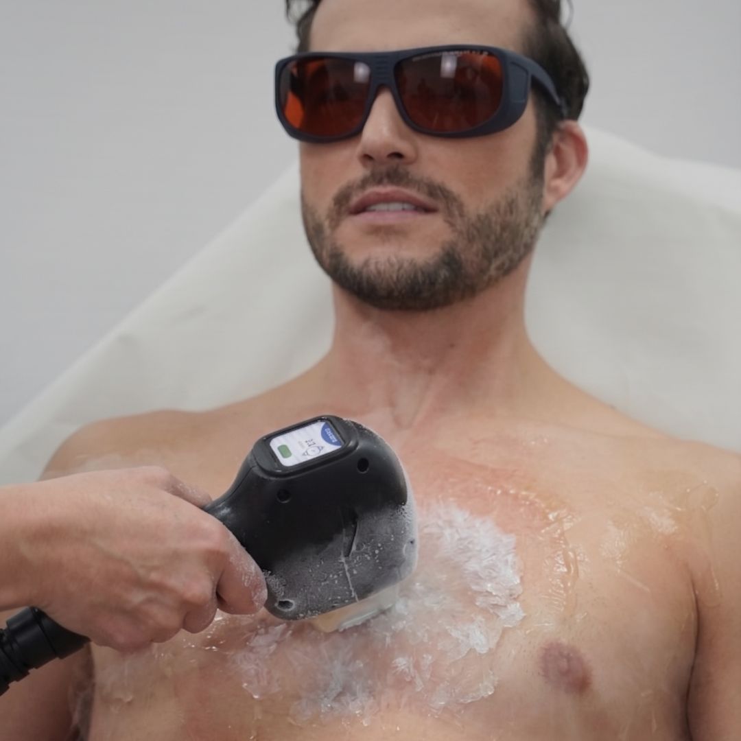 ICE láser™ · Cuerpo entero femenino/masculino